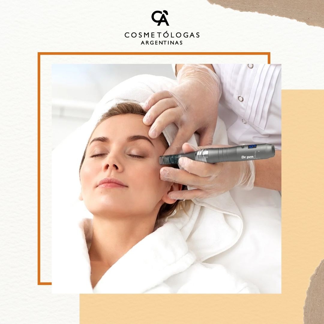 ¿Qué es el microneedling y para qué sirve?